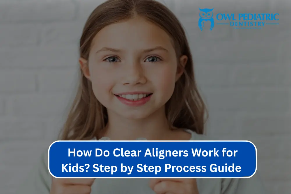 How Do Clear Aligners Work for Kids? Step by Step Process Guide
