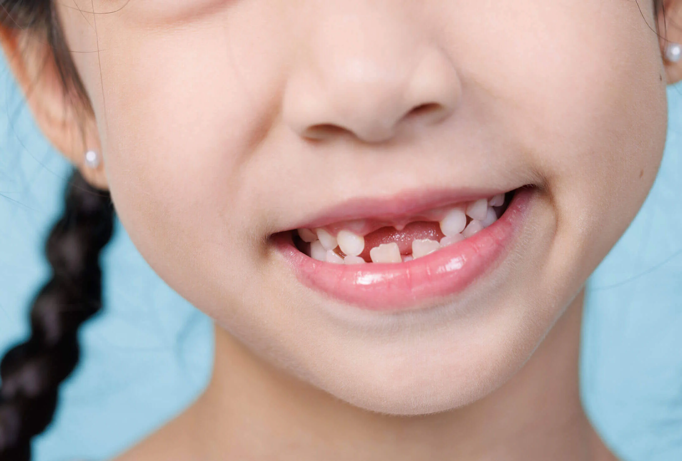 A young girl smiles brightly, showcasing a missing tooth in her front row of teeth.
