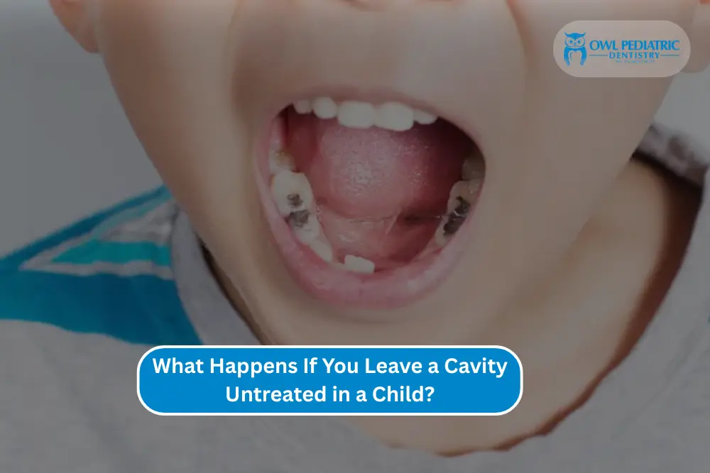 What Happens If You Leave a Cavity Untreated in a Child